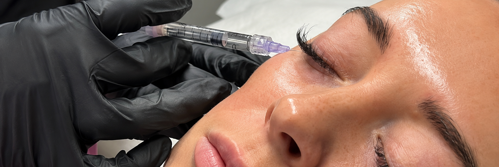 Profhilo skin rejuvenation treatments for the face and neck at Oakleigh Glow Aesthetics in Cliffe Woods, Medway.